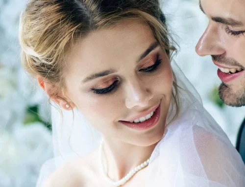 Sorriso perfetto per il Matrimonio
